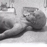 Alien Autopsy Fraud